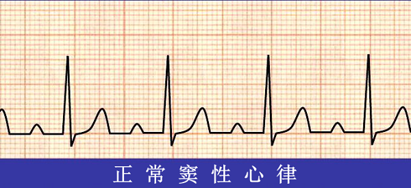 救命神器AED有多重要——你認(rèn)識(shí)它嗎？(圖6)